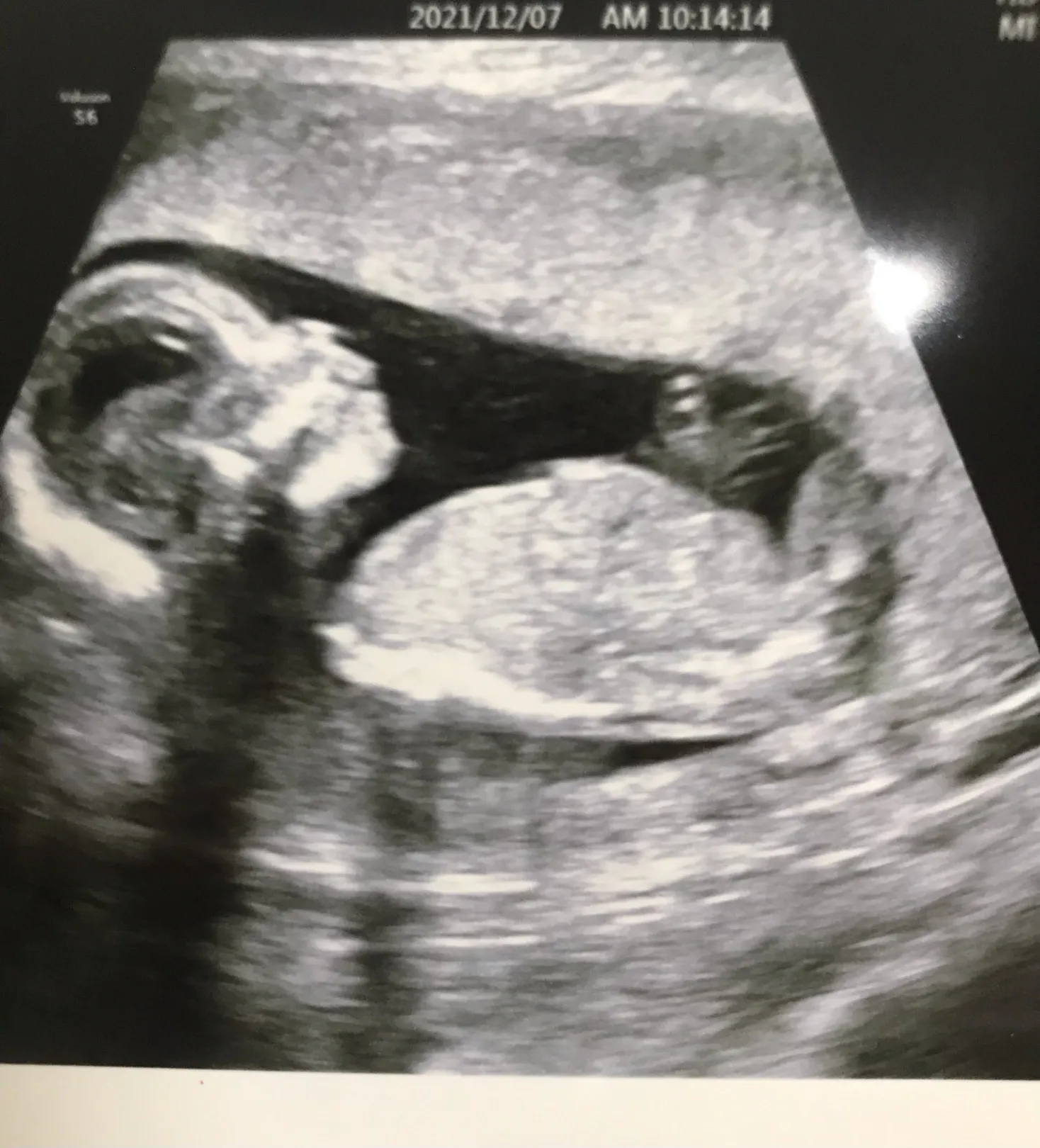 드뎌 성별확인👶🏻