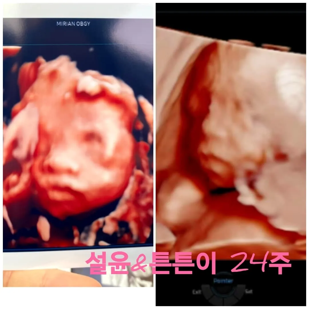 24주+1일 임당검사 거뜬하게 통과 했어요
