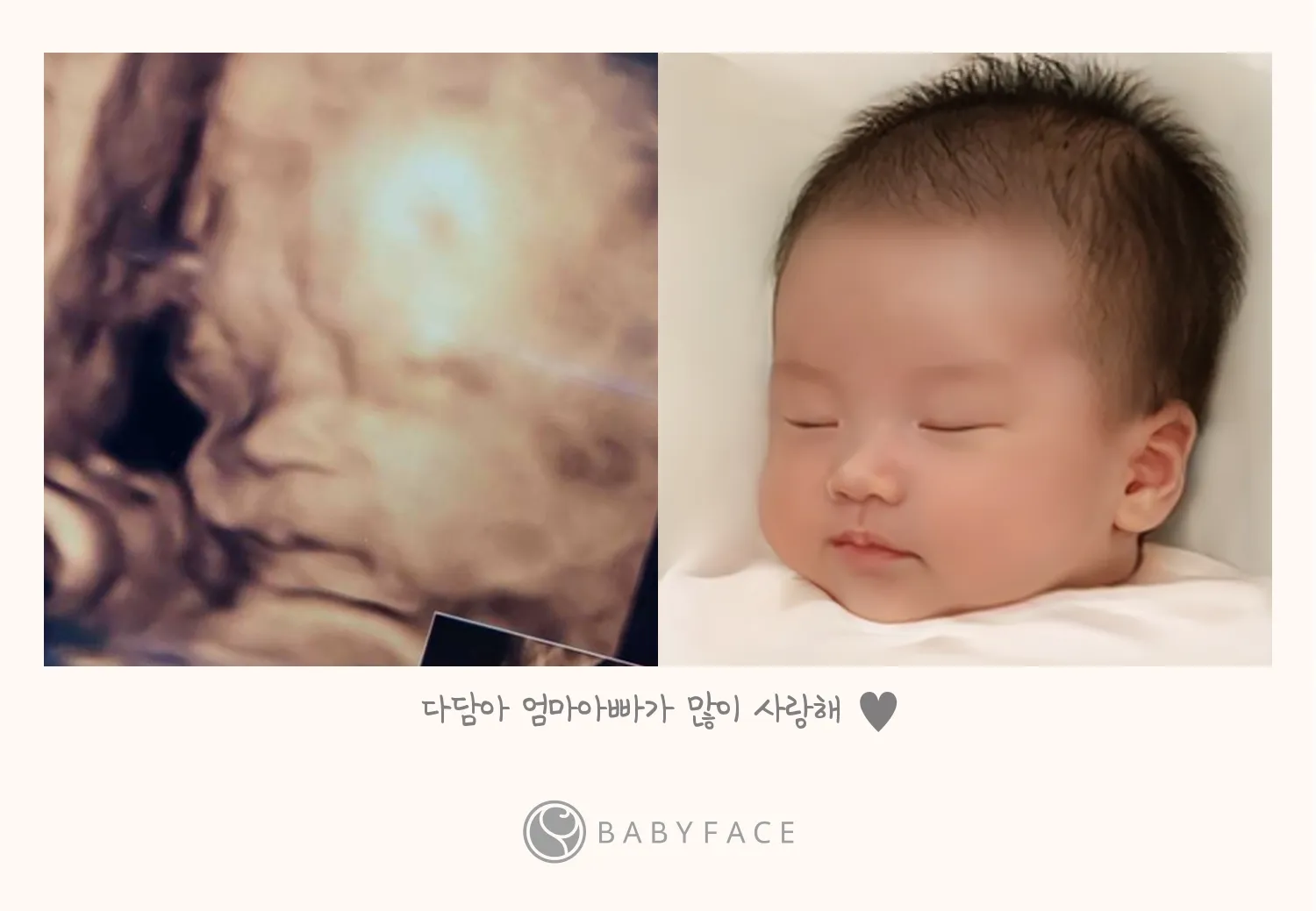 입체초음파와 베이비페이스