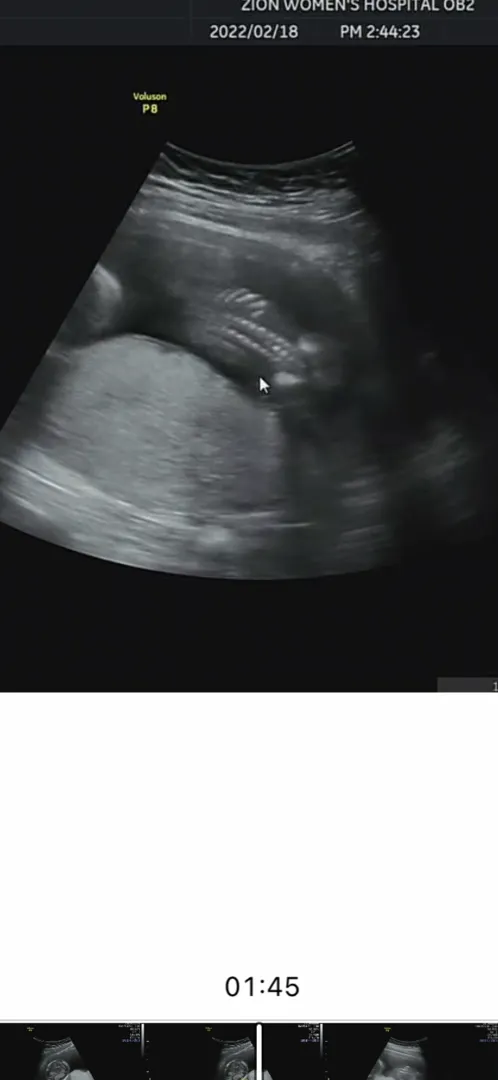 15주 6일