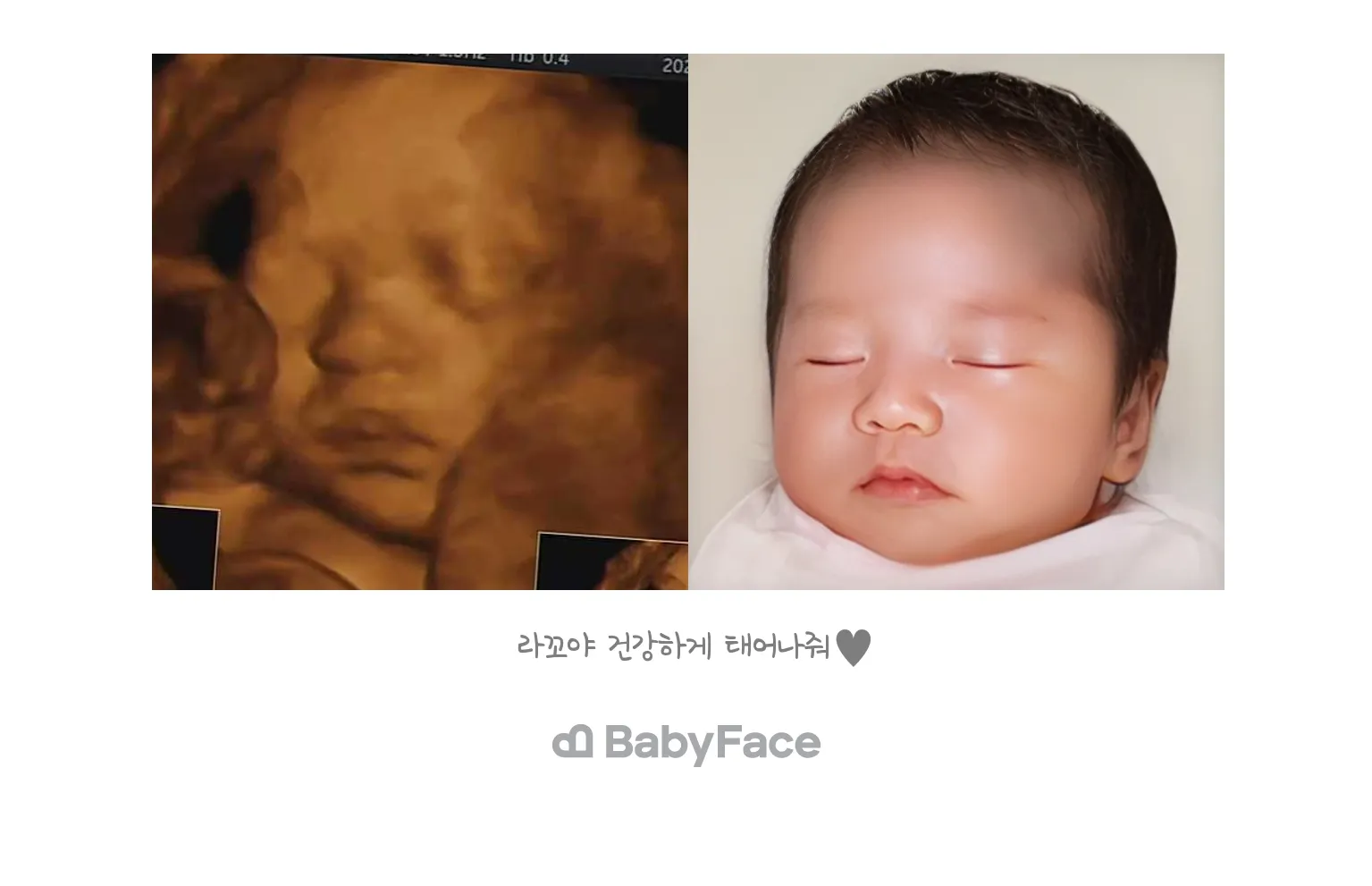 베이비 페이스