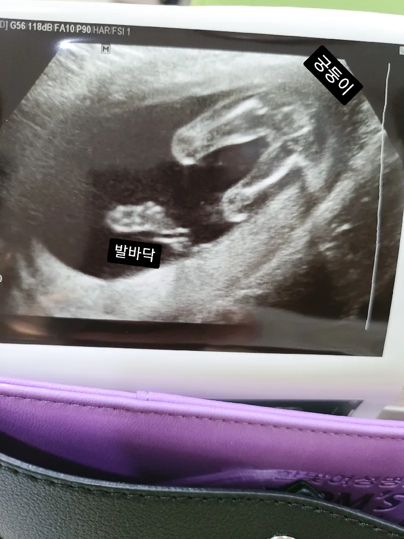 딸인가 아들인가~ :)