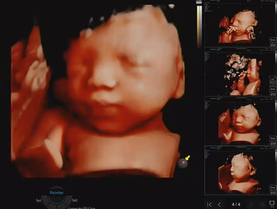29주차에 찍은 입체초음파 사진이에요!