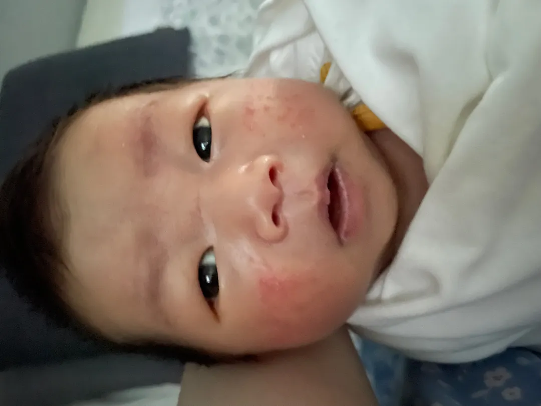 태열넘 심한데 방법이있나요ㅠ