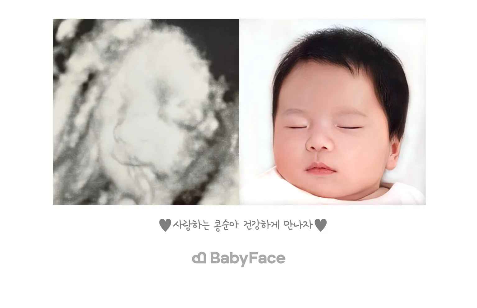 저도 베이비페이스 했어용🫶🏻