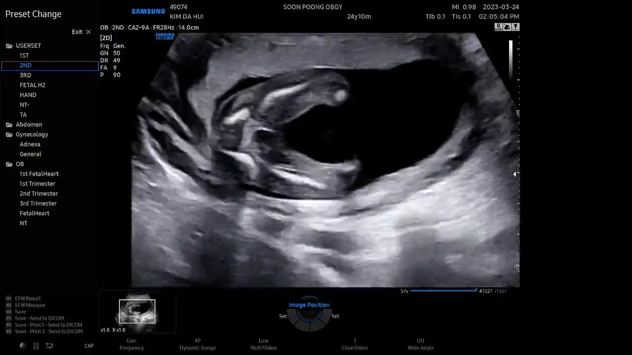 16w6d 딸램확정이에요~