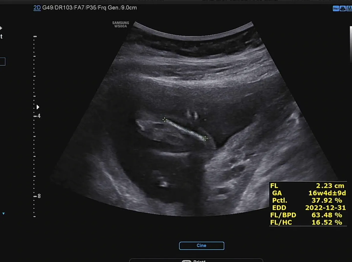 16주 6일