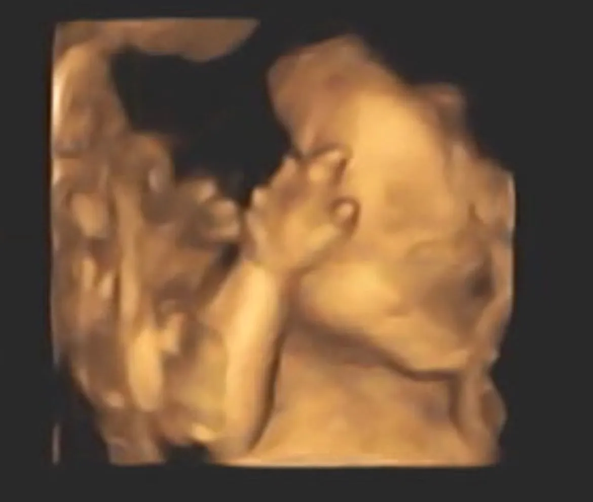 입체초음파 손모양