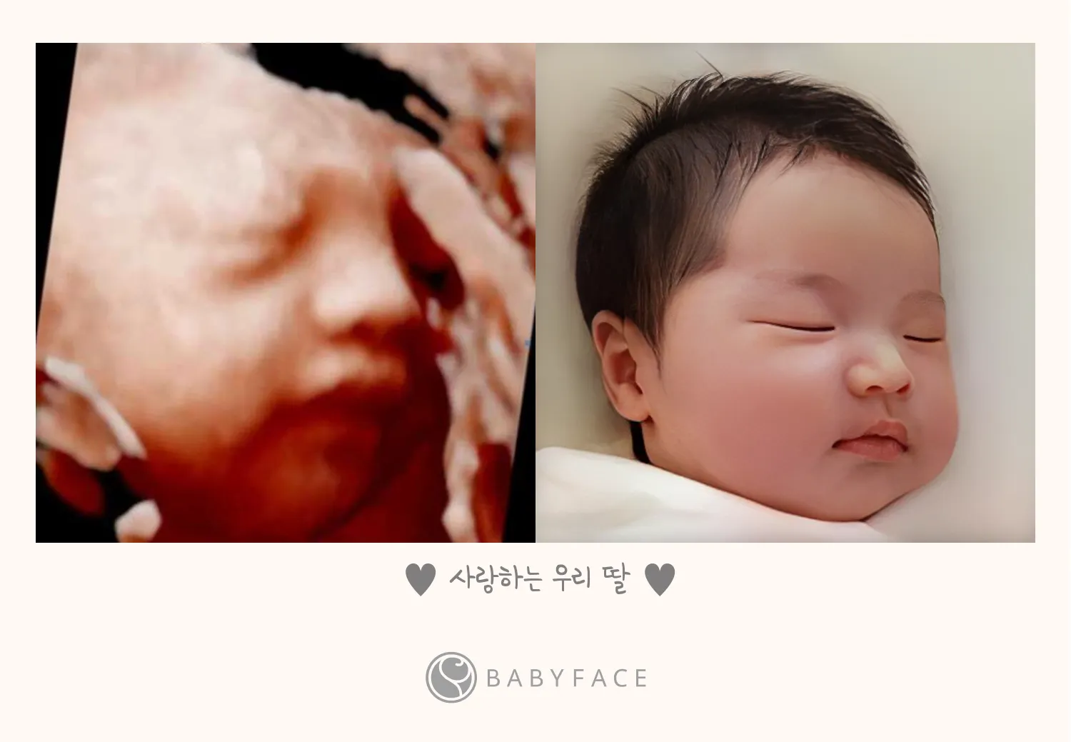 베이비페이스