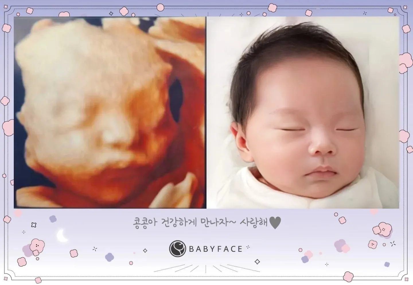 베이비 페이스 했어요~남편 판박이ㅎㅎ