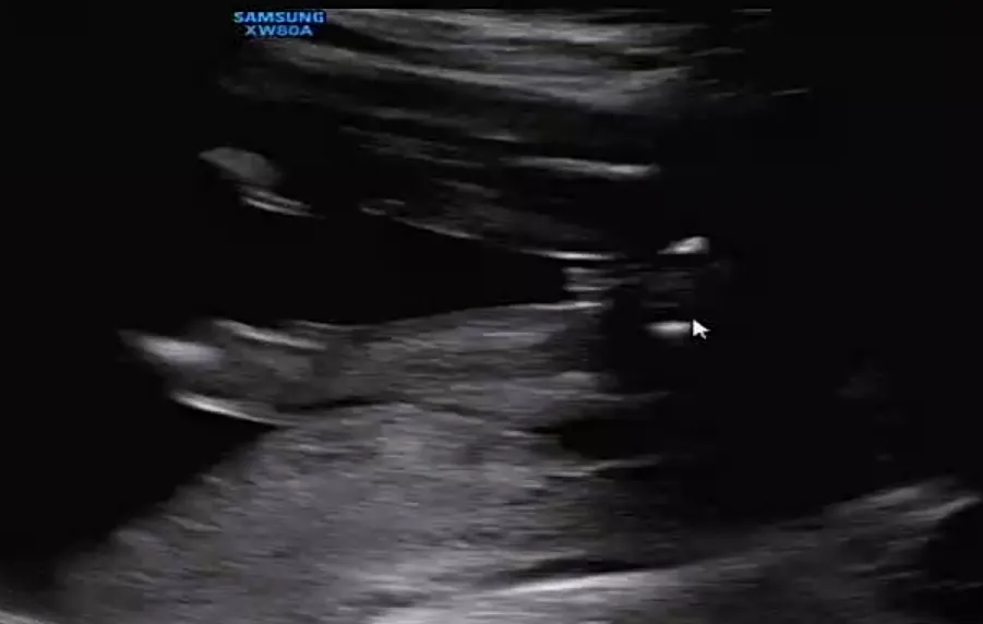 21준데 아가 성별을 몰라요~딸 맞죠?