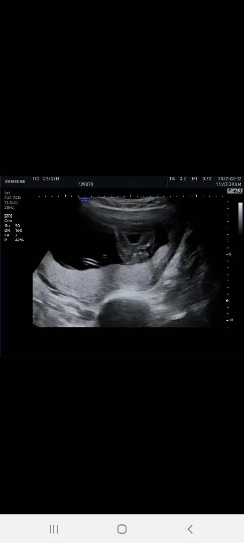 15주6일차입니다 ㅎㅎㅎ 딸인거같다고 하셨는데