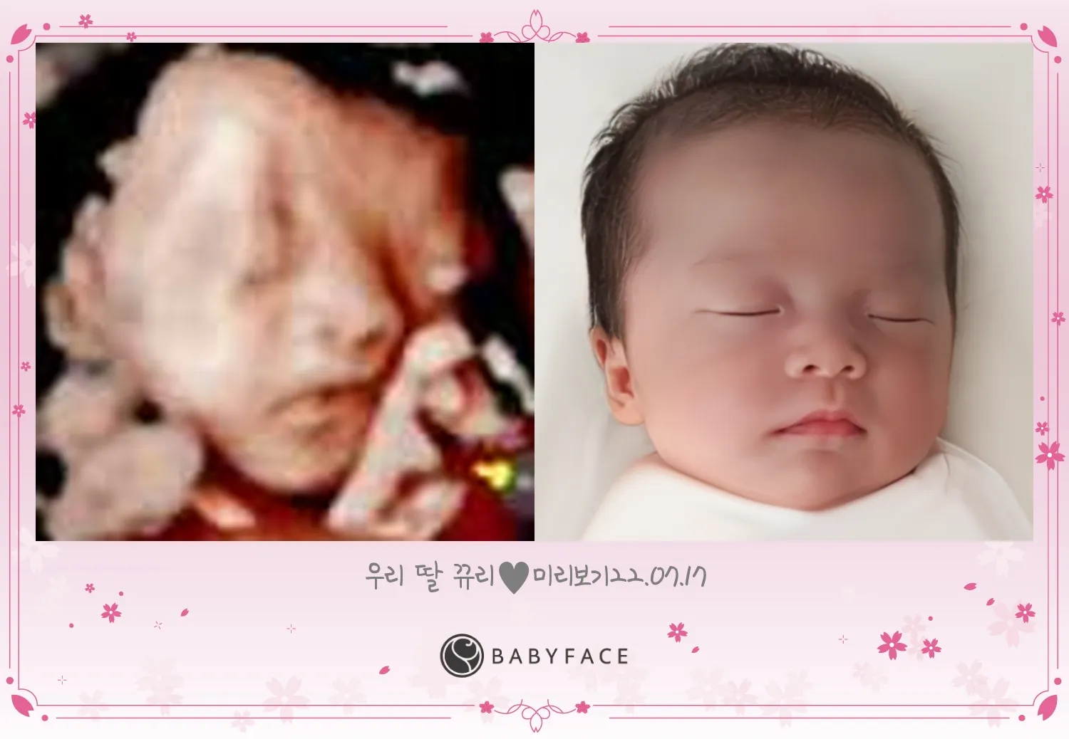 저도 베이비페이스 해봤어요