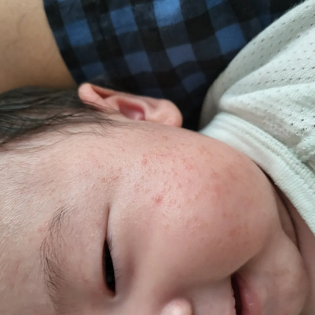 이거 태열인가요ㅠㅠㅠ