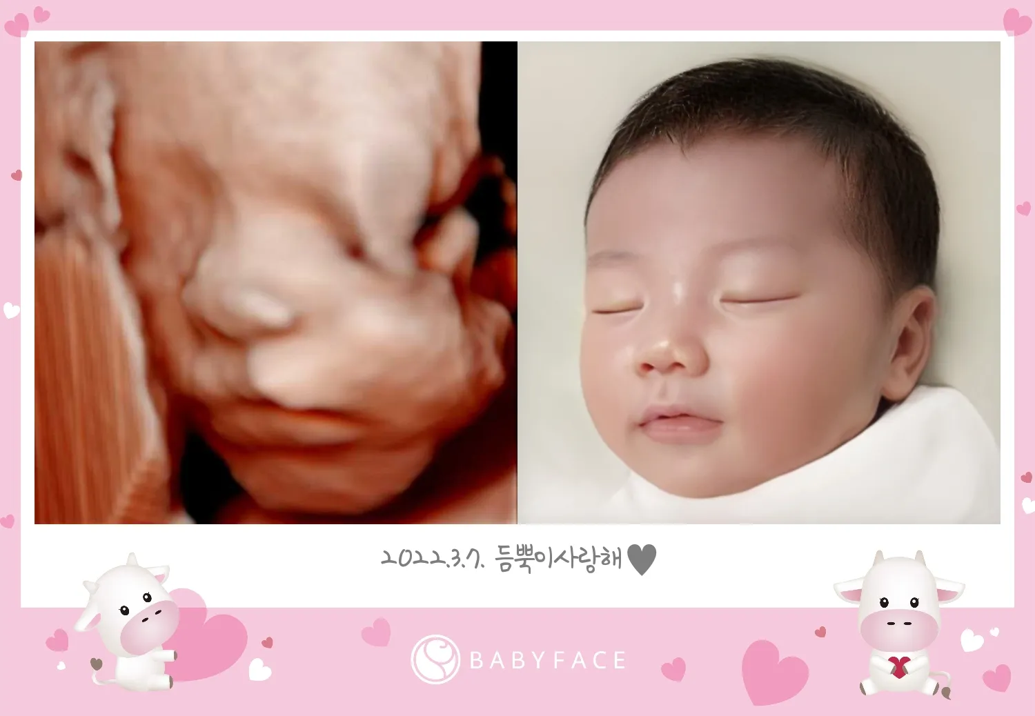 입체초음파로 베이비페이스해봣어용
