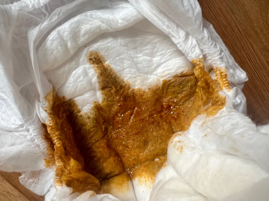 아기 기저귀 좀 봐주세요 (사진 있음)