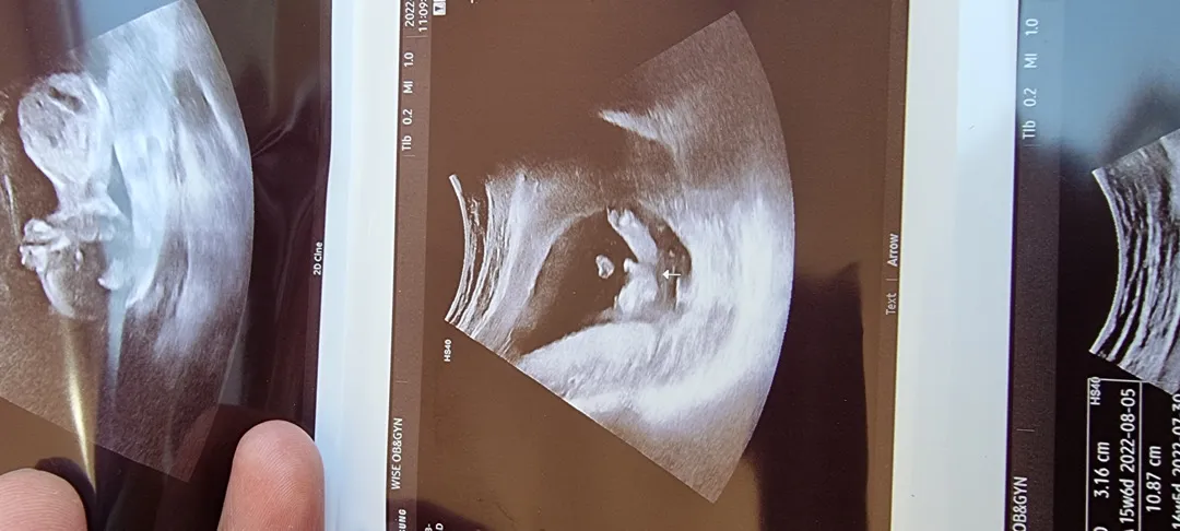 15주 4일 성별 좀 봐주세여 ㅠㅠ