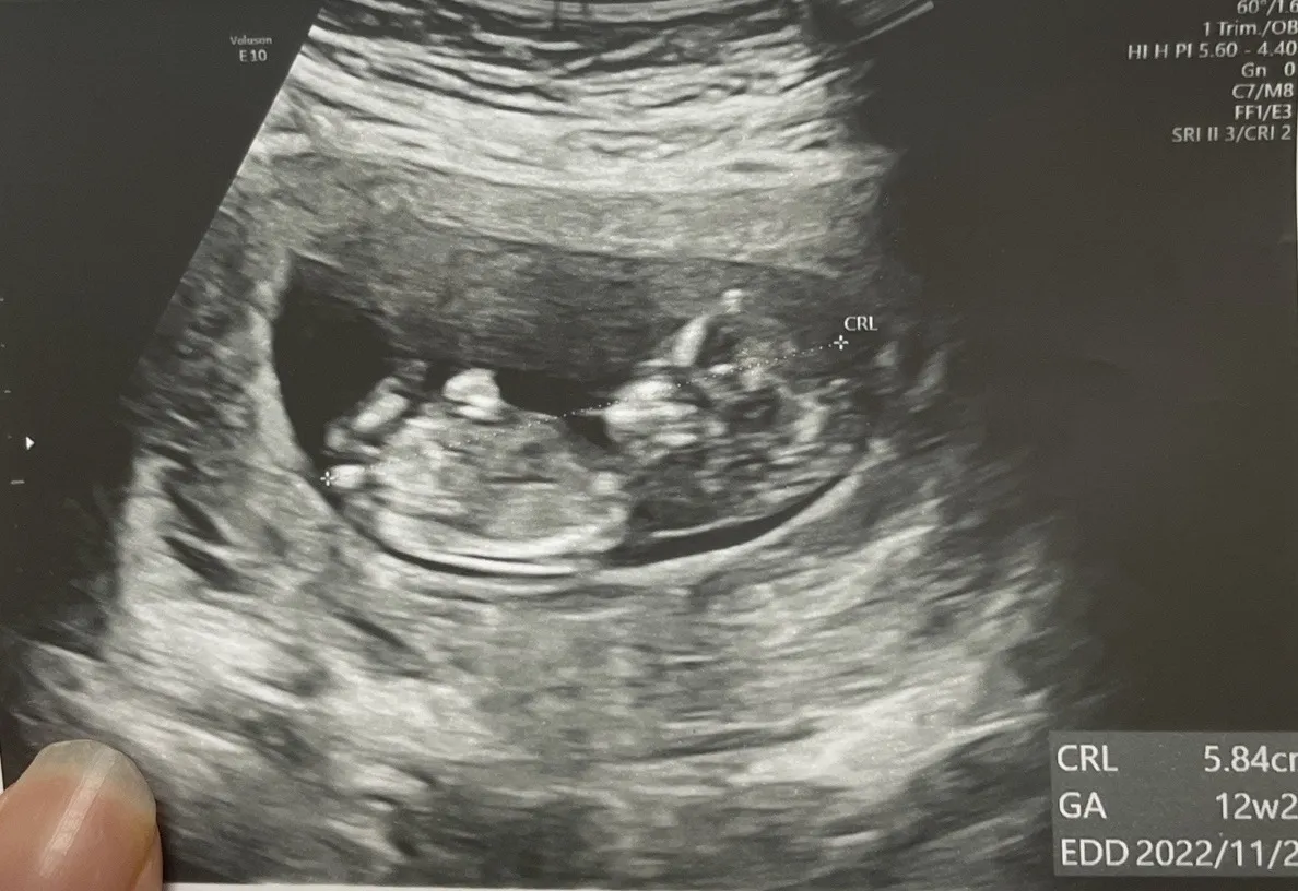 community post image