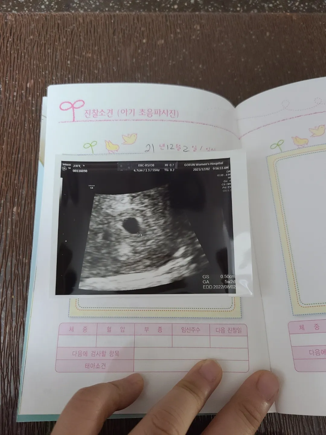두번째'찾아온 생명..