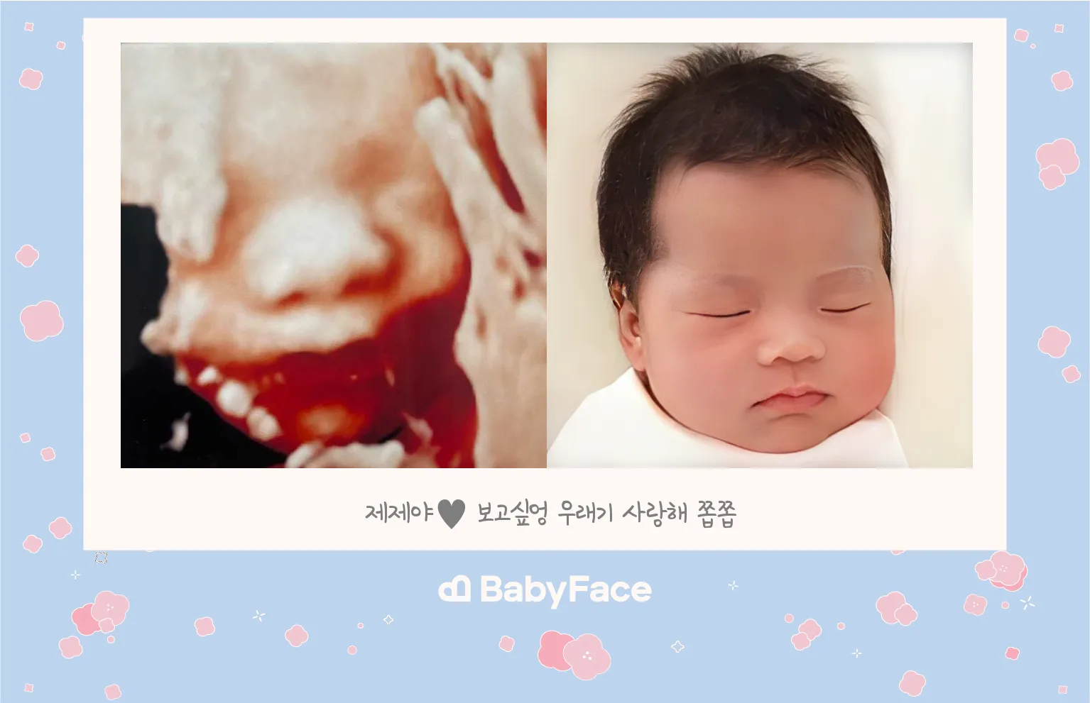 저도 했네요 ㅋㅋㅋ 베이비페이스..