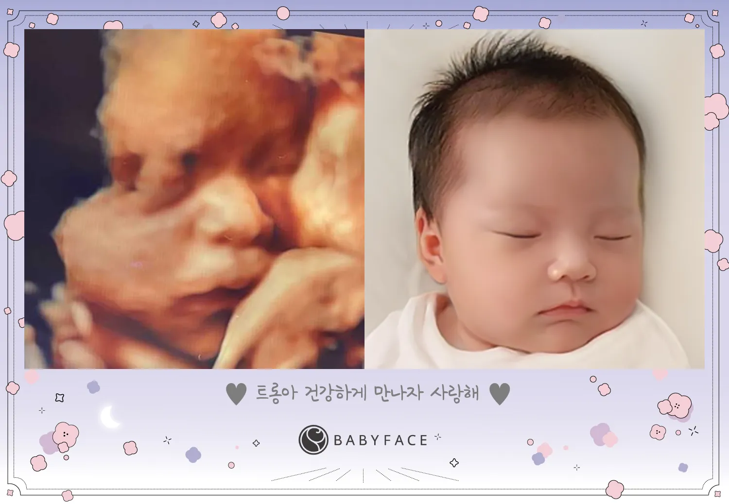 28주 입체초음파 베이비페이스 해봐썽요!!!
