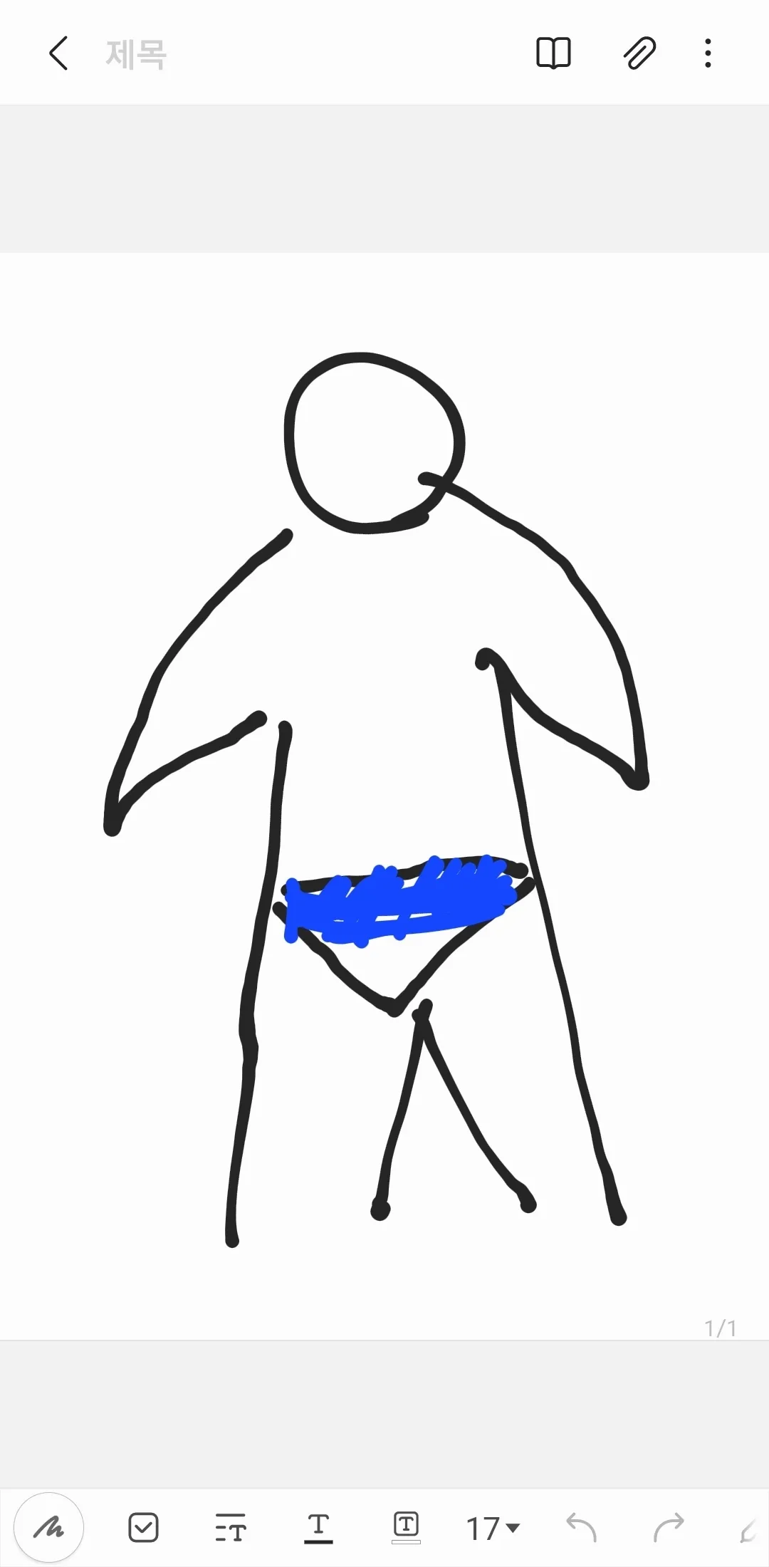 10주차 정도 된 산모분들~ 혹시 이부분 나오셨/부풀으셨나요?