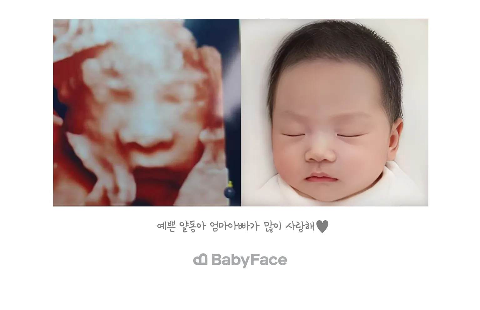 베이비페이스 했어요 ㅎㅎ