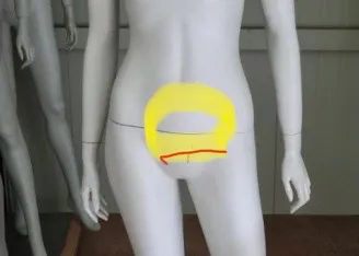 제왕절개6일차 마사지 가능한가요?