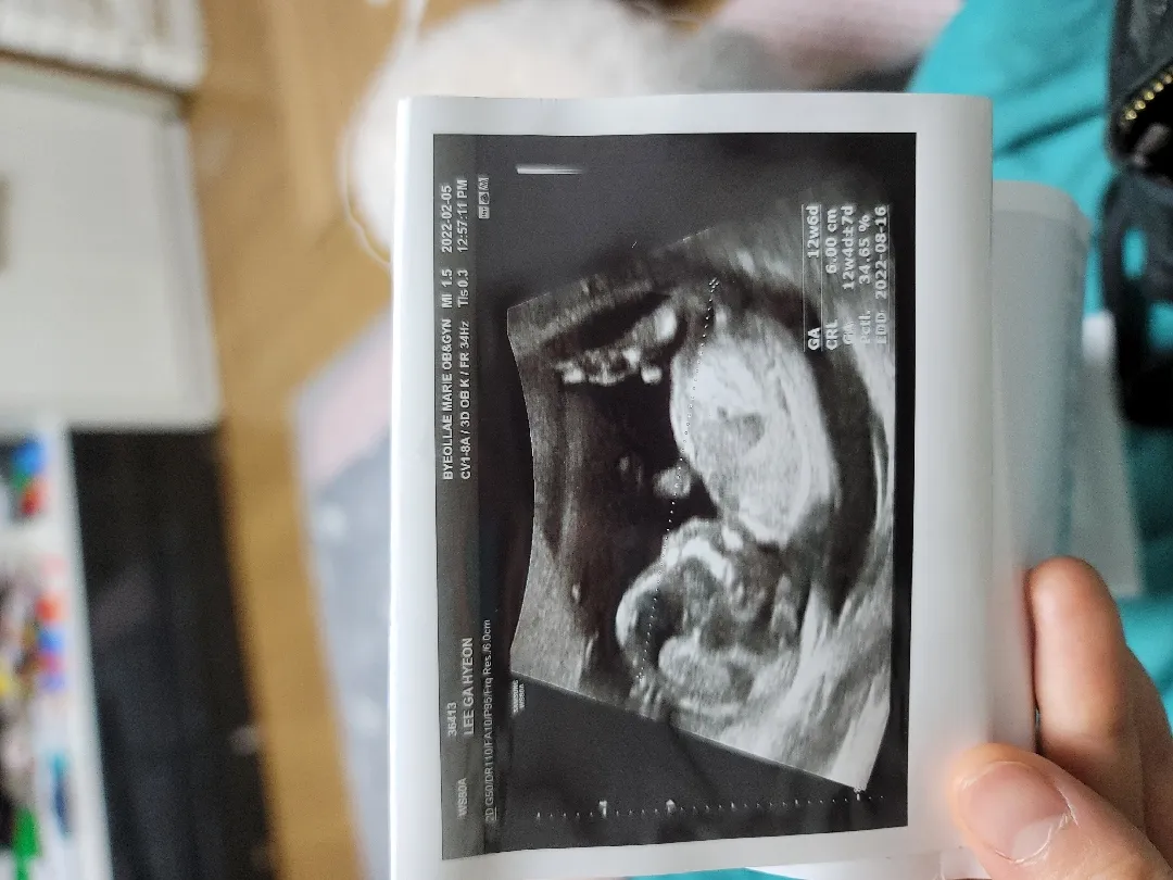 12주6일 아기집이나 아기크기 어떻게 되세요???