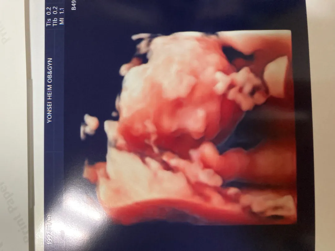 23주 정밀촘파 보고왔어용