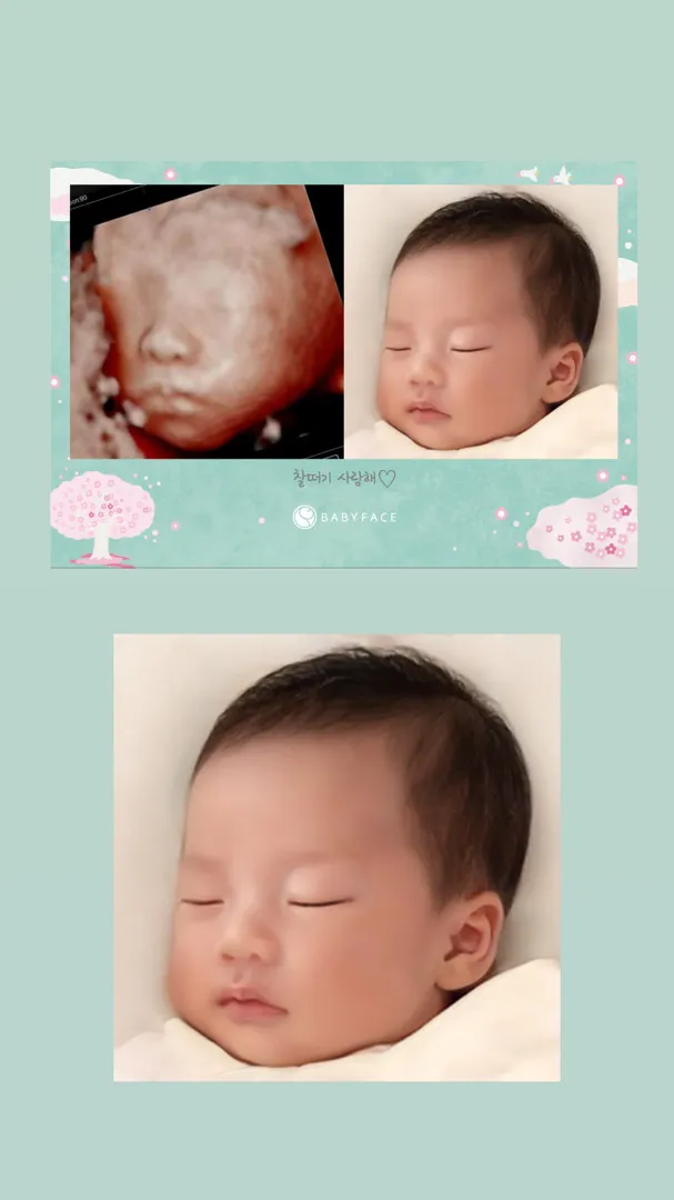 베이비 페이스💚