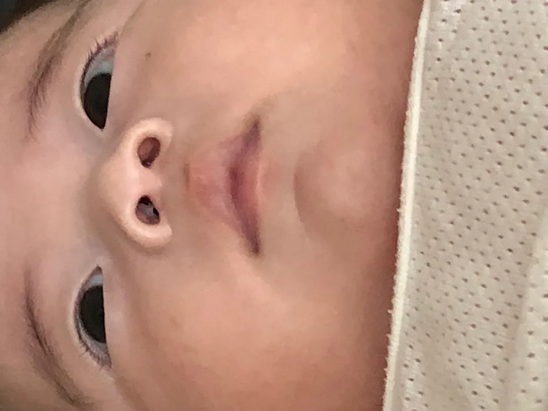 태열에어컨땜에약간의감기기운병원