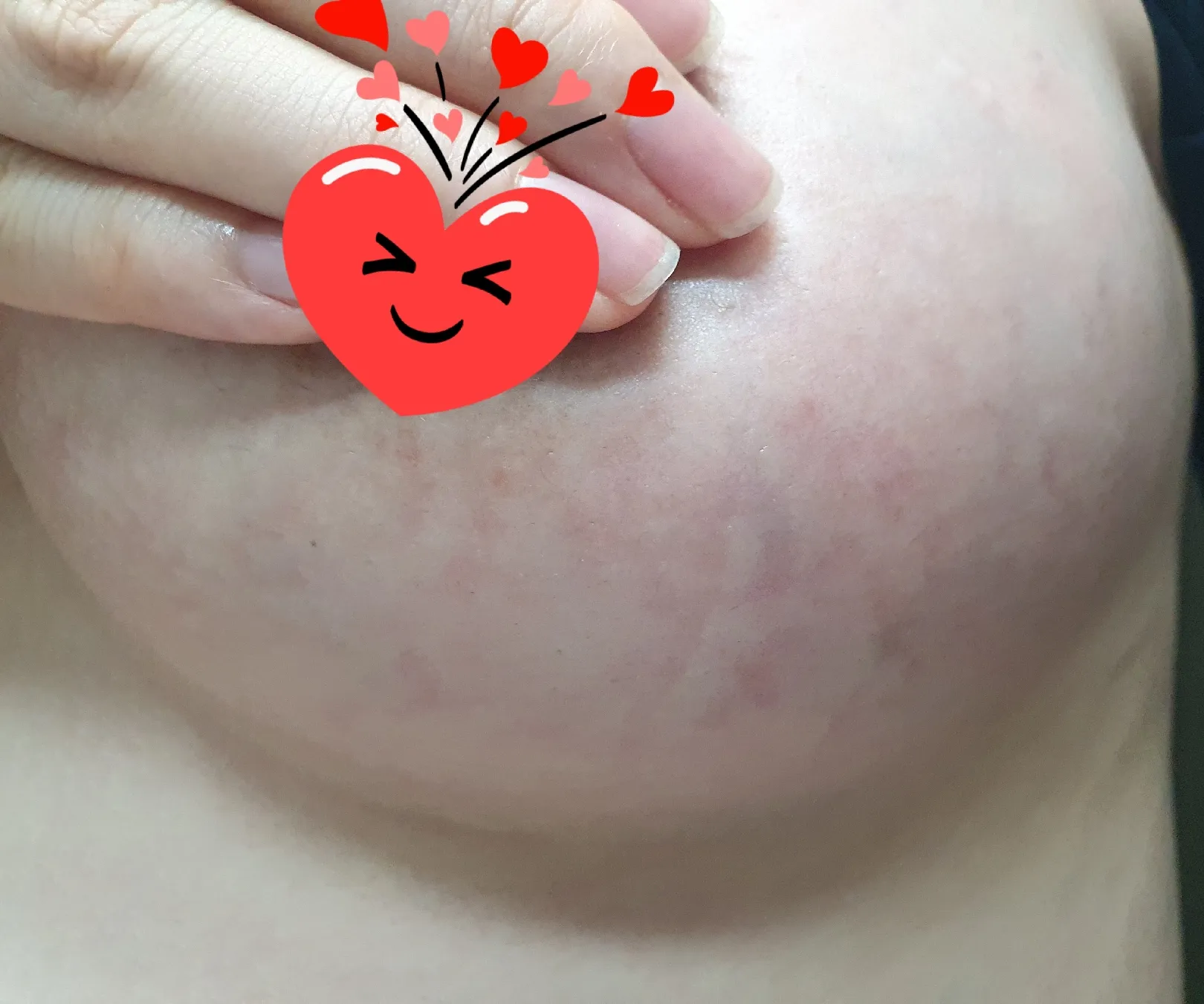 이미 다 튼걸까요????