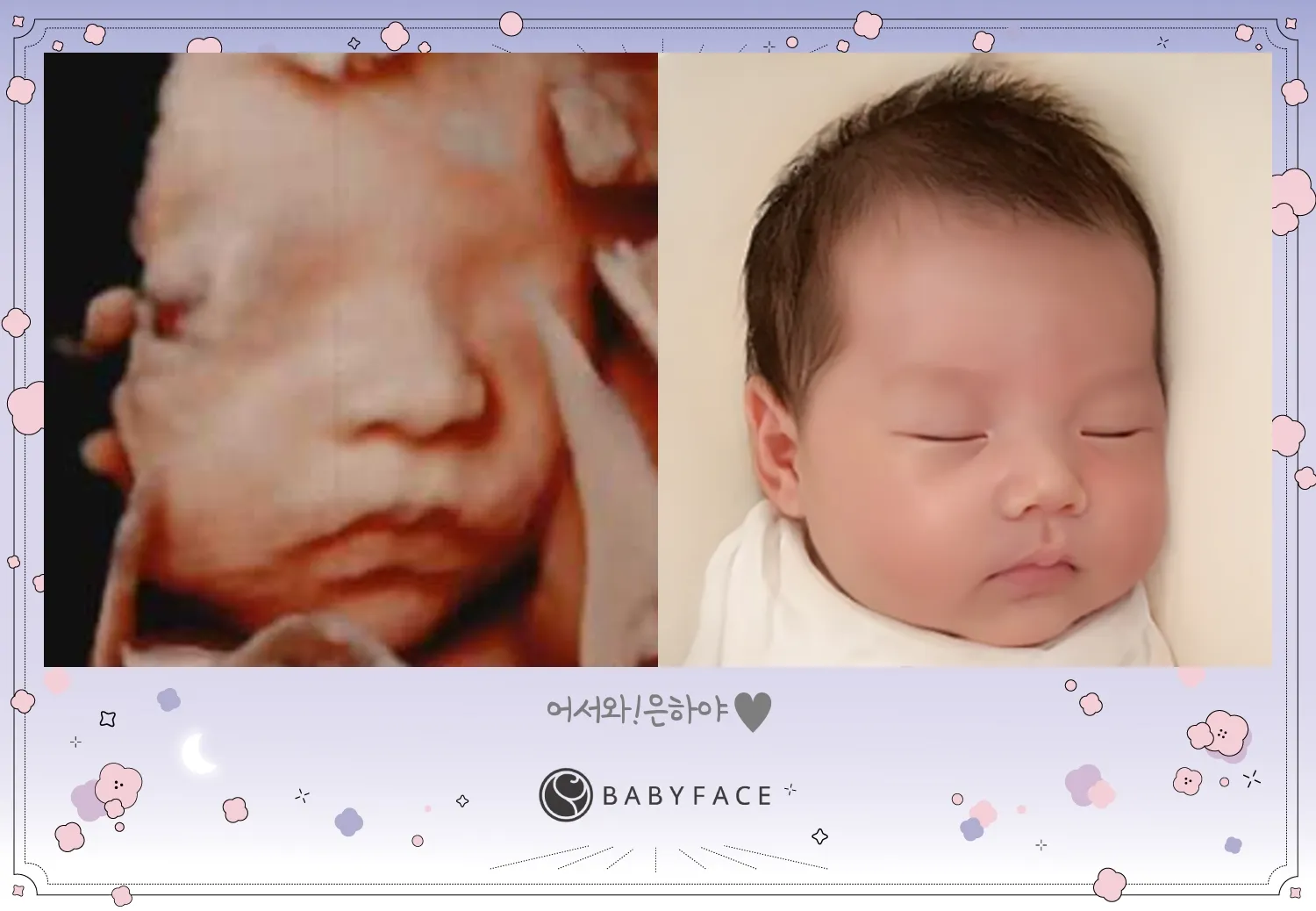 입체초음파했어요 ㅎㅎ