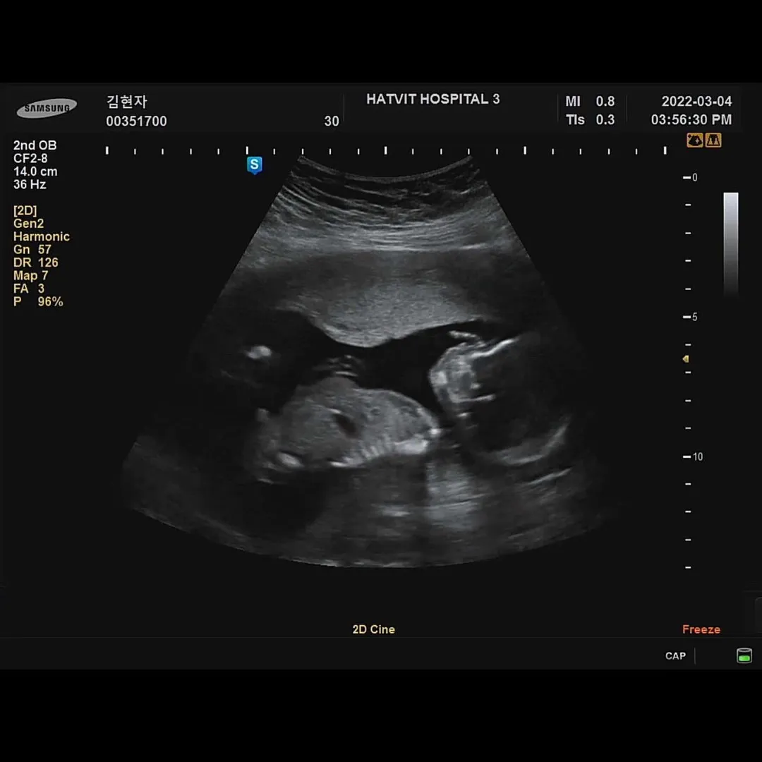 16주6일차 ... 성별궁금해요