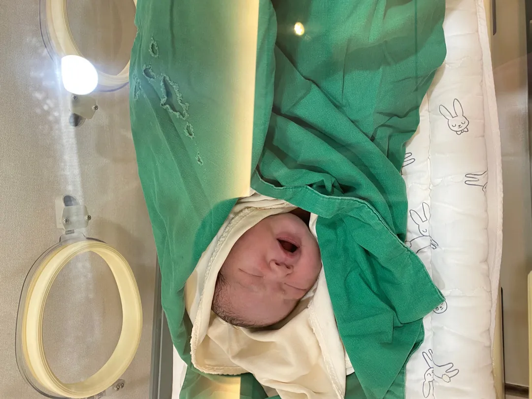 제왕절개ㅡ  A.M 09:31 3.6kg 딸 출산👶🏻