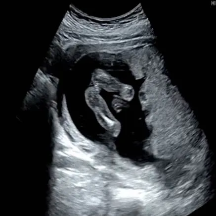 16주 5일 성별 알게됬어요!!