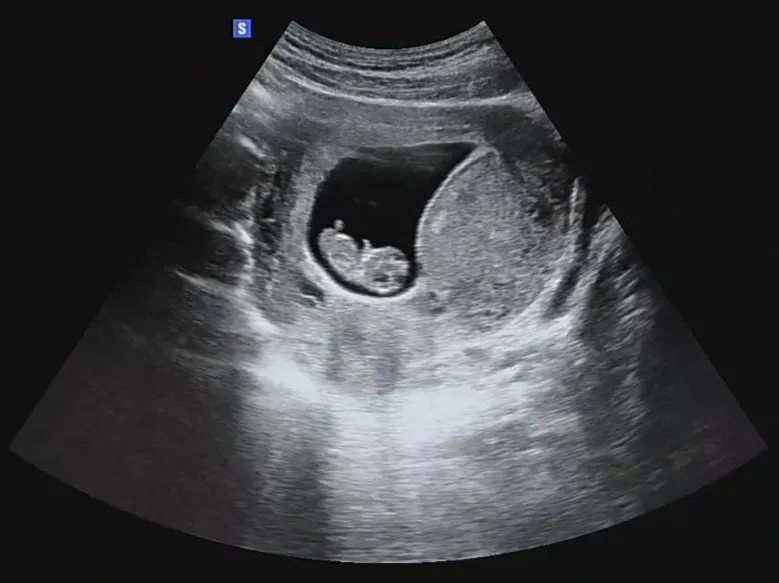 community post image