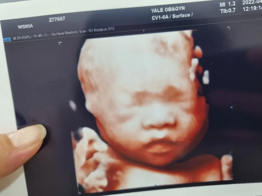 입체초음파..자랑♡