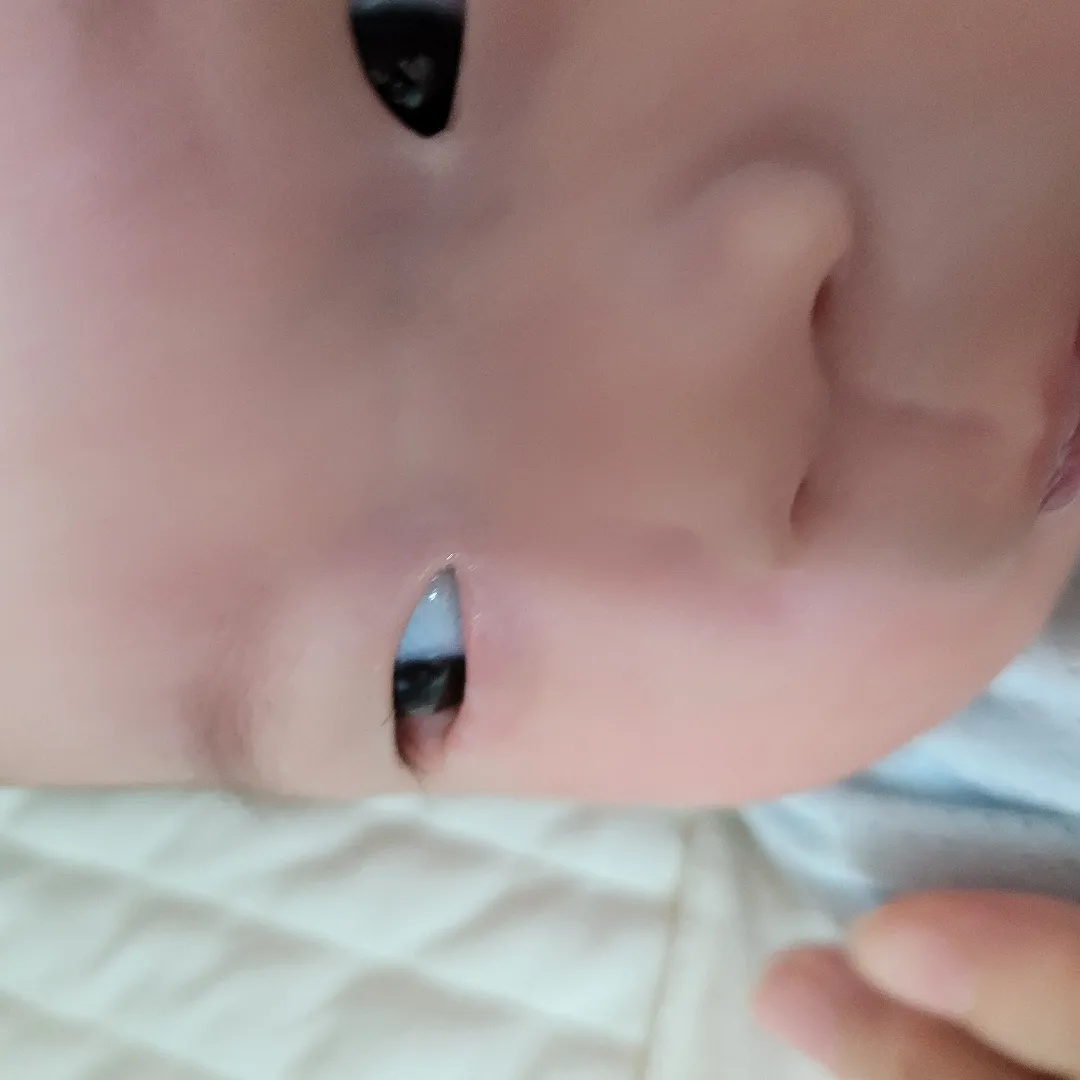 아기 눈 밑에 뭐가 빨갛게 났어요ㅠ