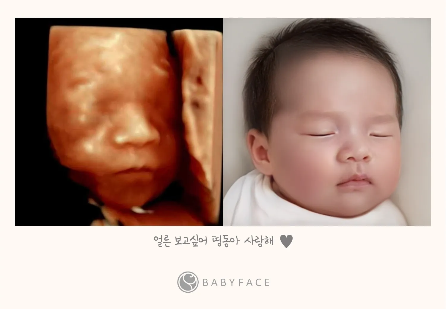울아들 베이비페이스♡
