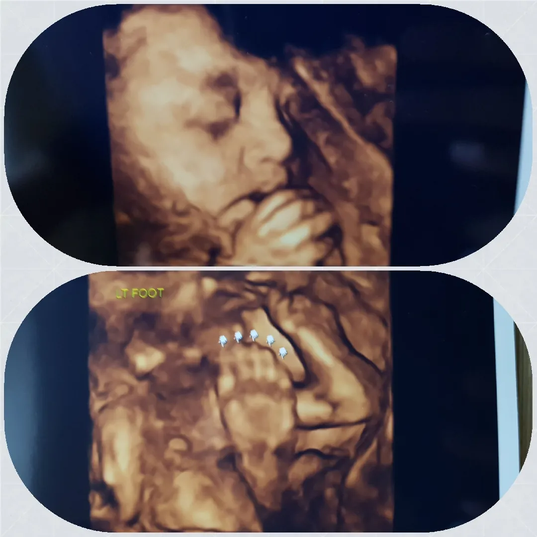 사랑스런 짹짹이  쨔잔♡