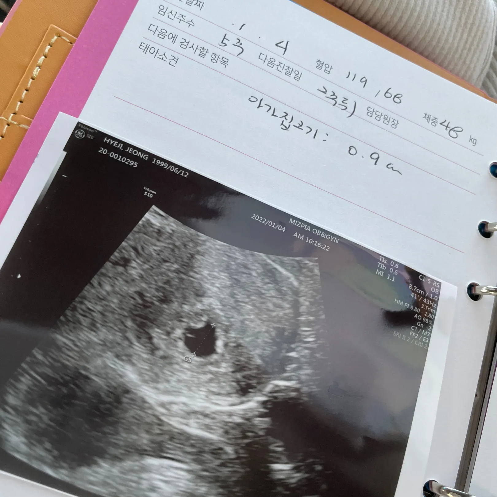 아기집 확인하구왔어용ㅋㅋ