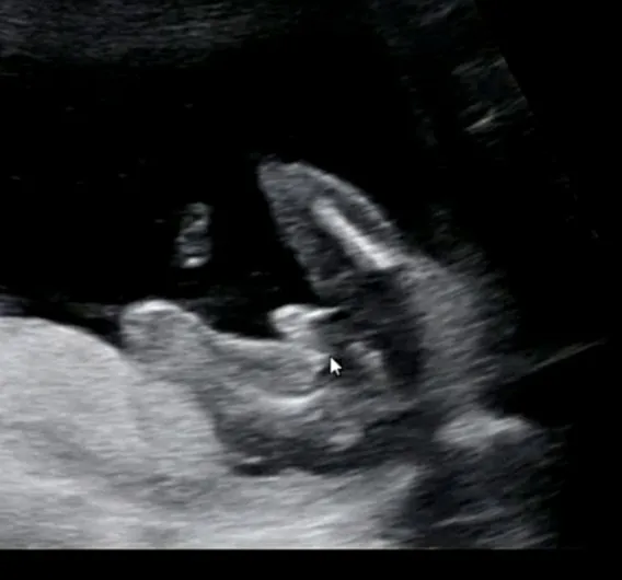 community post image