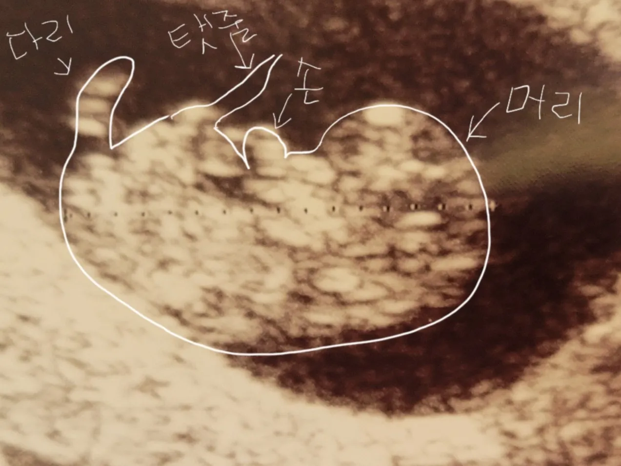 하리보 보러갔다가 사람보고왔어요ㅋㅋ