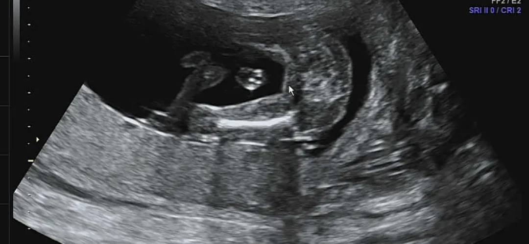 16주차 아가 성별 보고왔어요👶