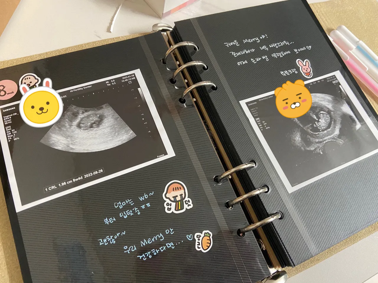 초음파 앨범 꾸미기 📝