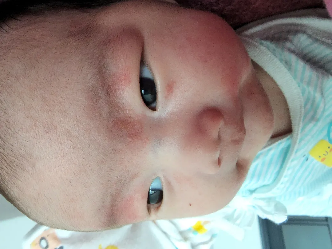아기눈쪽에