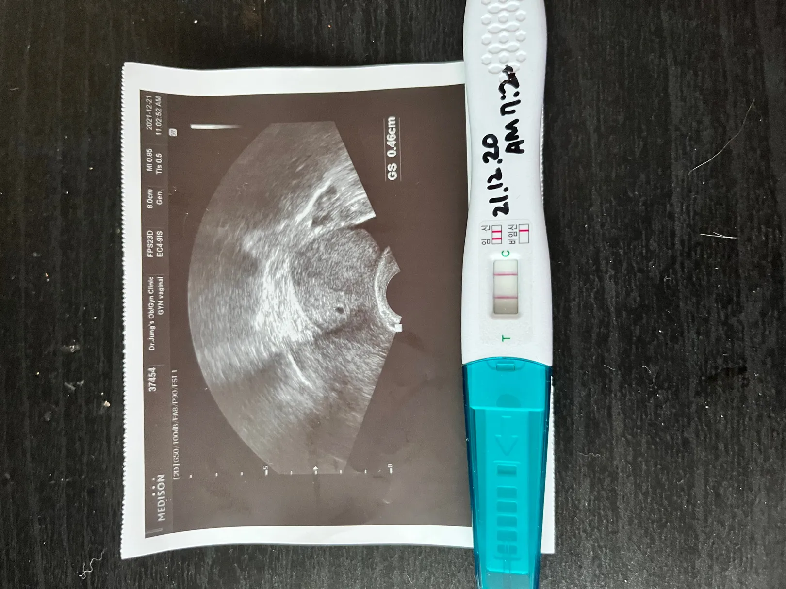 저번주에 아기집