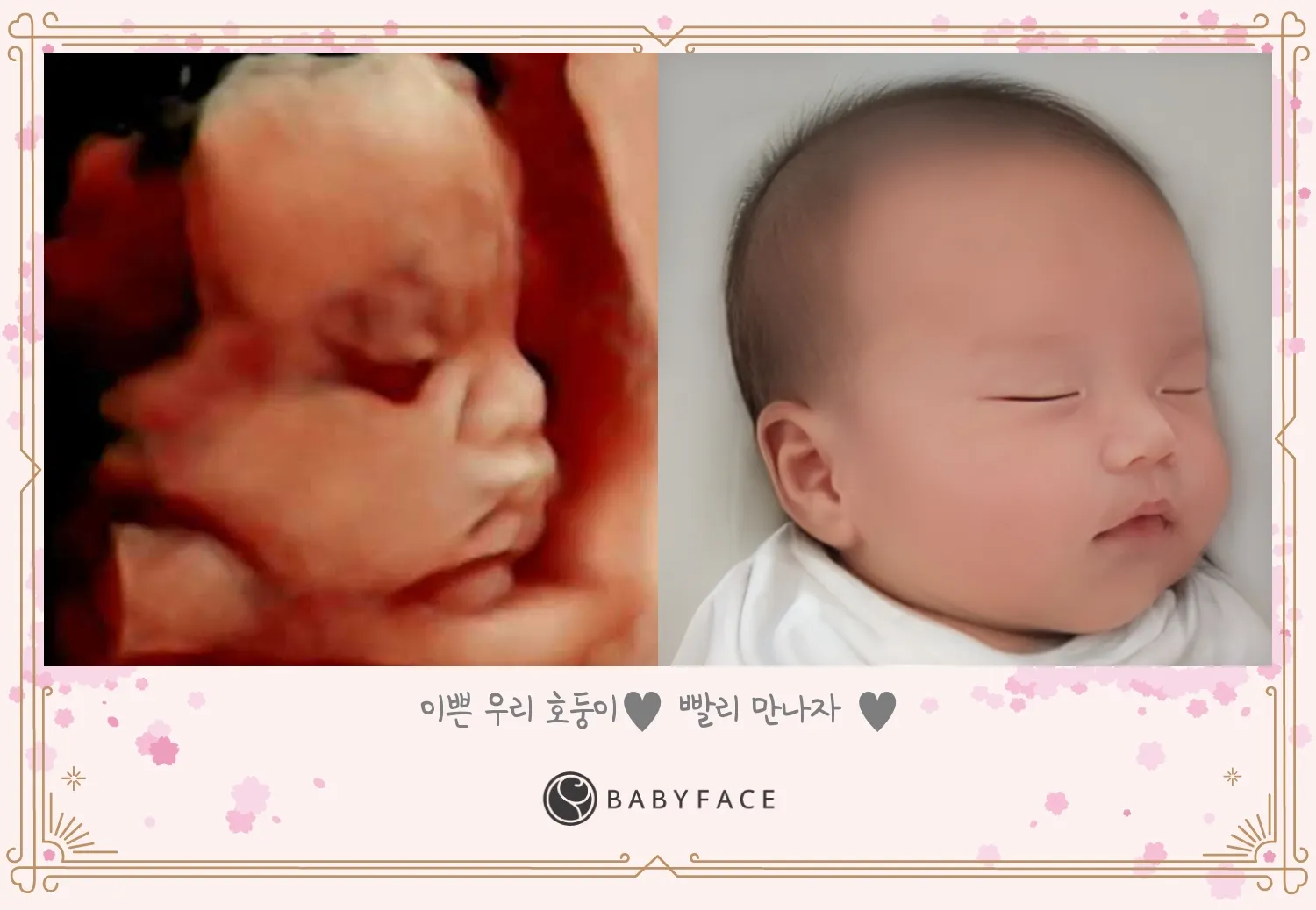 저도 베이비페이스했어요!